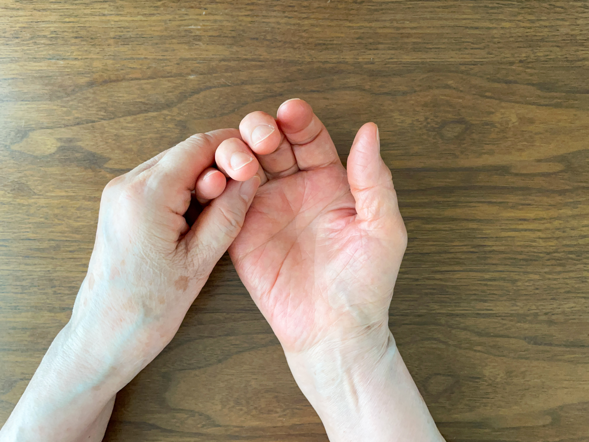 小指と薬指のしびれを気にして手を見つめる女性のイメージ
